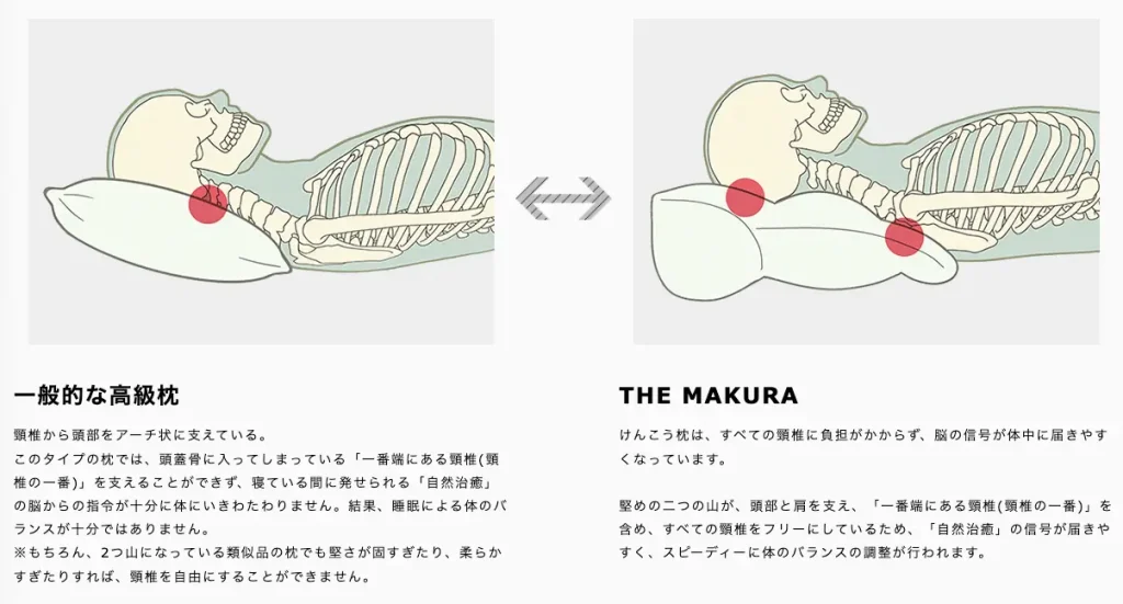 THE MAKURAキュアレの口コミや評判-デメリットや怪しい？ステマ？の  